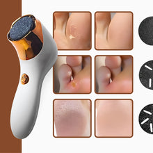 Carregar imagem no visualizador da galeria, Kit Removedor Elétrico de Calos para Pés - BRANCO